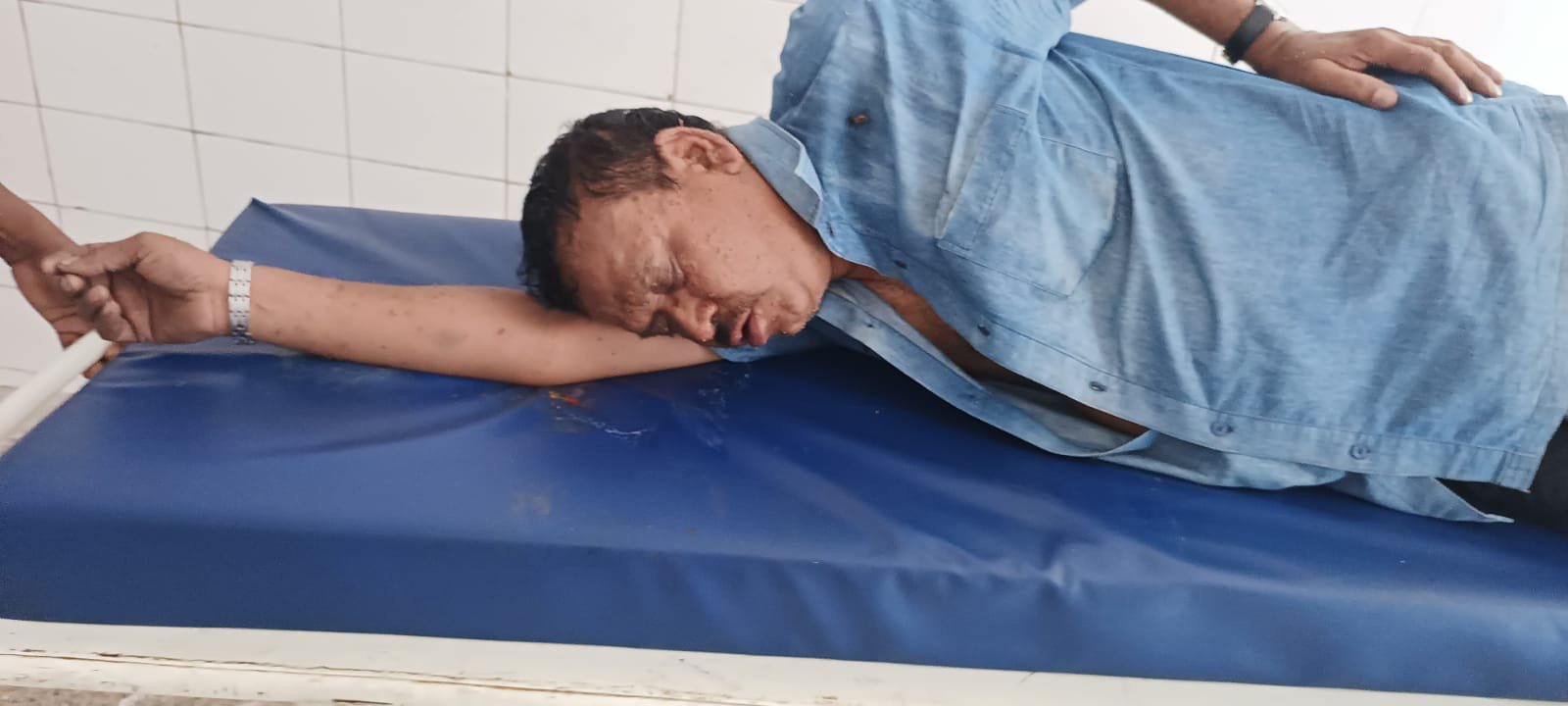 मधुमक्खियों के हमले में कई घायल